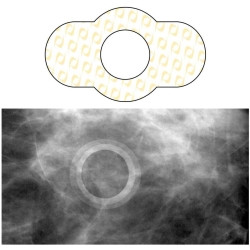 Skin Marker Spee-D-Ring™ Yellow / White 0.5 Inch Inside Ø  (100/BX)