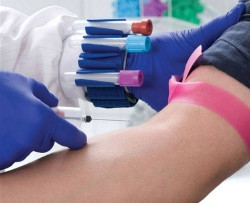 Tube Jockey Wristband / Holder Set For Holding 13 - 16 mm Tubes  (1/EA)