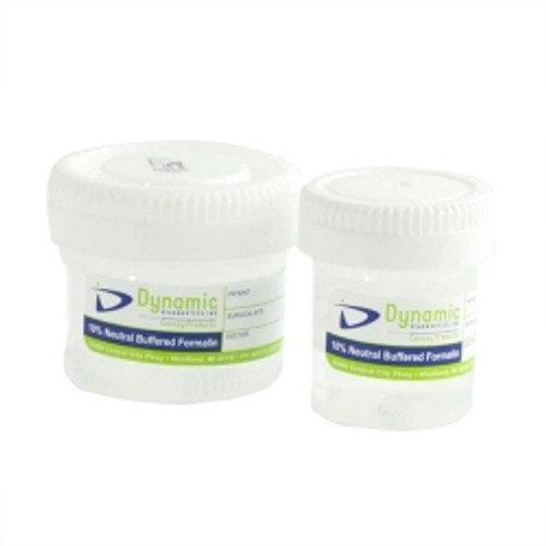 Prefilled Formalin Container 20 mL Fill in 40 mL (1.35 oz.) Screw Cap Patient Information NonSterile (M-1193635)