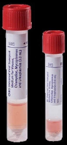 Universal Viral Transport Vial 1 mL, 2 to 25°C For Directigen EZ Flu A+B and Directigen EZ RSV Test Kits (M-936878)