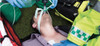 i-Gel O2 Resus Pack in use another view #2