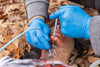 Emergency Cricothyrotomy Kit IN USE 2