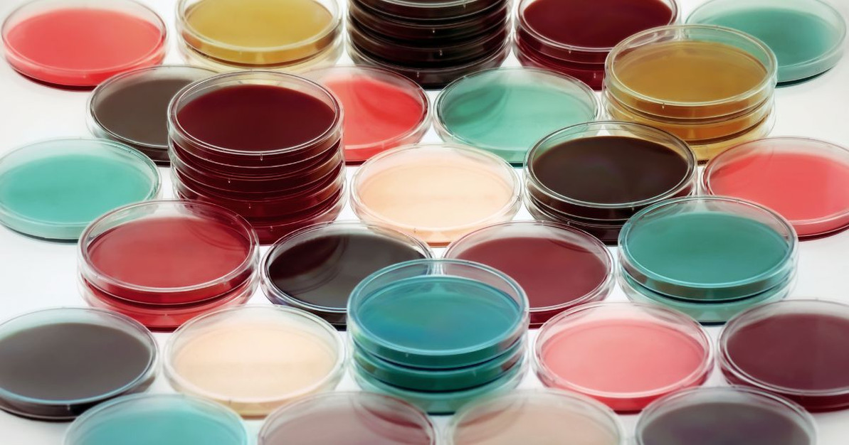 Sustainable Petri Dishes in Modern Microbiology Laboratories: Choosing the Right Vented Solution