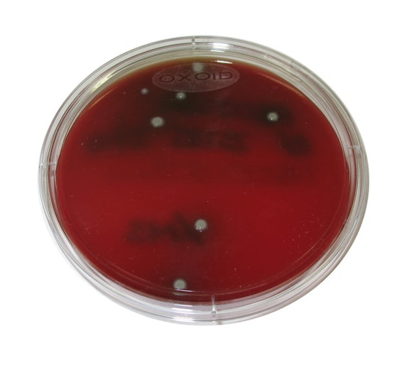 Fastidious Anaerobe Agar (F.A.A.) with Horse Blood 90mm Pk10