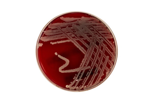 Blood Agar (TSA with Sheep Blood) Medium 90mm Plates Pk 10