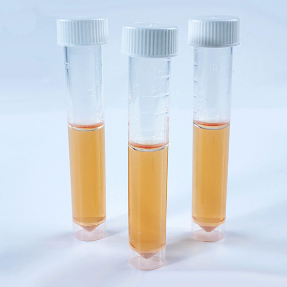 NRB Test Pk 10