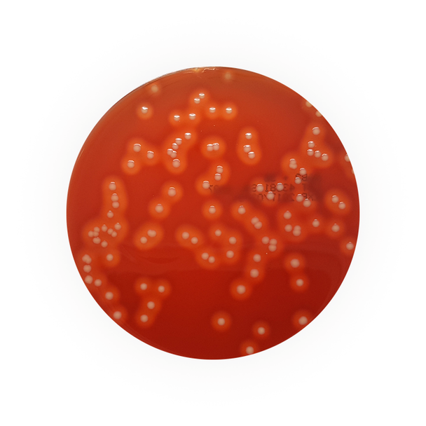 Blood Agar No.2 with 5% Sheep Blood 90mm PP Plates Pk 10