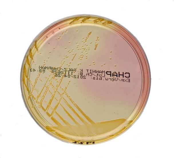 Oxoid™ Mannitol Salt Agar 90mm Pre-Poured Plates Pk 10 Oxoid™ Mannitol Salt Agar 90mm Pre-Poured Plates Pk 10