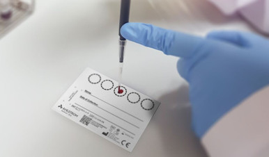 Dry Blood Spot Cards CE with Perforated Circles Pk 100 - Trafalgar ...