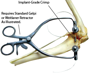 Product VOI Cruciate Tension Clamp | J0710R Image