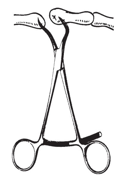 Product Spectrum Bone Reduction Forcep, 5.5" (14cm), Curved, Stepped Pointed, Long Ratchet | SAH.20-1113 Image