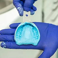 Choosing the Right Dental Impression Material for Your Practice