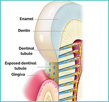 Desensitizers & Post-Operative Sensitivity: Improving Patient Comfort After Restorative Procedures