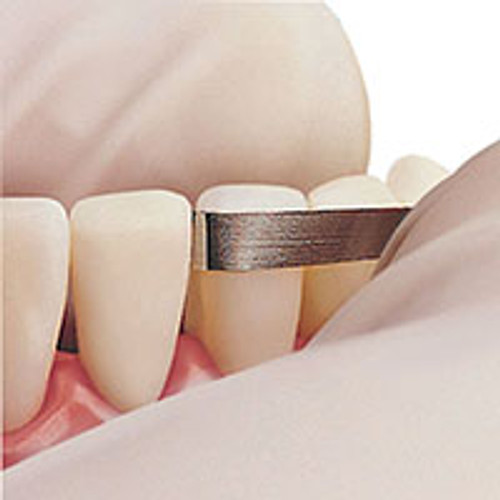 Premier - Compo-Strips Assorted Premier - Compo-Strips Assorted