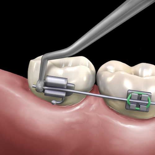 Distal Cinch Back Hand Instrument, Hu-Friedy, 678-506 Distal Cinch Back Hand Instrument, Hu-Friedy, 678-506