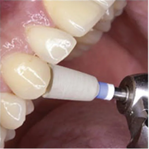 SHOFU CERAMASTER POLISHING, 0123