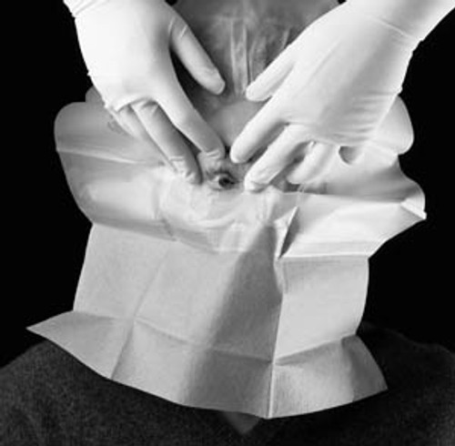 3M STERI-DRAPE OPHTHALMIC SURGICAL DRAPES, 1062 3M STERI-DRAPE OPHTHALMIC SURGICAL DRAPES, 1062