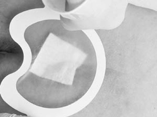 3M TEGADERM HP (HOLDING POWER) TRANSPARENT FILM DRESSING, 9546HP