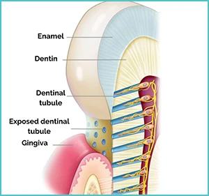 Desensitizers & Post-Operative Sensitivity: Improving Patient Comfort After Restorative Procedures