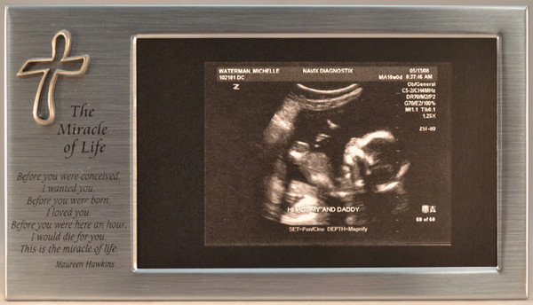 Sonogram or Ultrasound frame