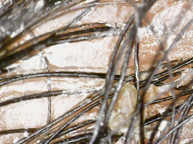 how-does-african-american-hair-grow-pivotal-products-llc