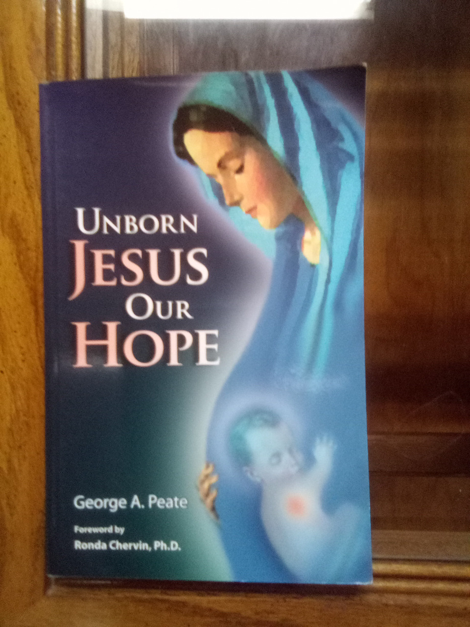 Unborn Jesus Our Hope Paperback – August 1, 2006 by George A. Peate (Author) -  A GENTLY USED BOOK IN GOOD CONDITION WITH A LITTLE CREASE ON THE COVER.

Unborn Jesus Our Hope takes the reader on a spiritual journey into the life of Christ hidden within the virginal womb of Mary. The nine months Jesus spent in utero are in many ways so unique that they reverberate throughout salvation history - and yet they also include the very same experiences shared by every baby. Mary's womb has become a holy temple in her Fiat to God's call to participate in His plan of redemption, and so one can truly say that the Church's first devotion is to Unborn Jesus. Enter into the mystery and beauty of our salvation, which began in the unborn Christ's life. All Christians will find comfort in reading this profound meditation.

 