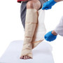 Super absorbent leg wrap dressing applied around lower leg and foot for wound management
