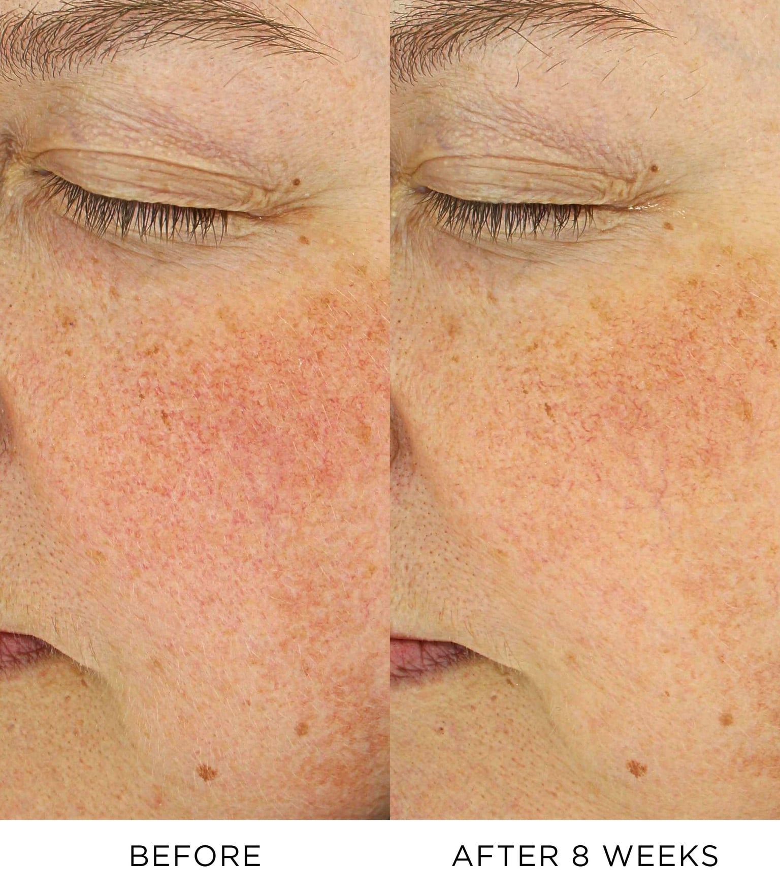 Vitamin C Booster 3