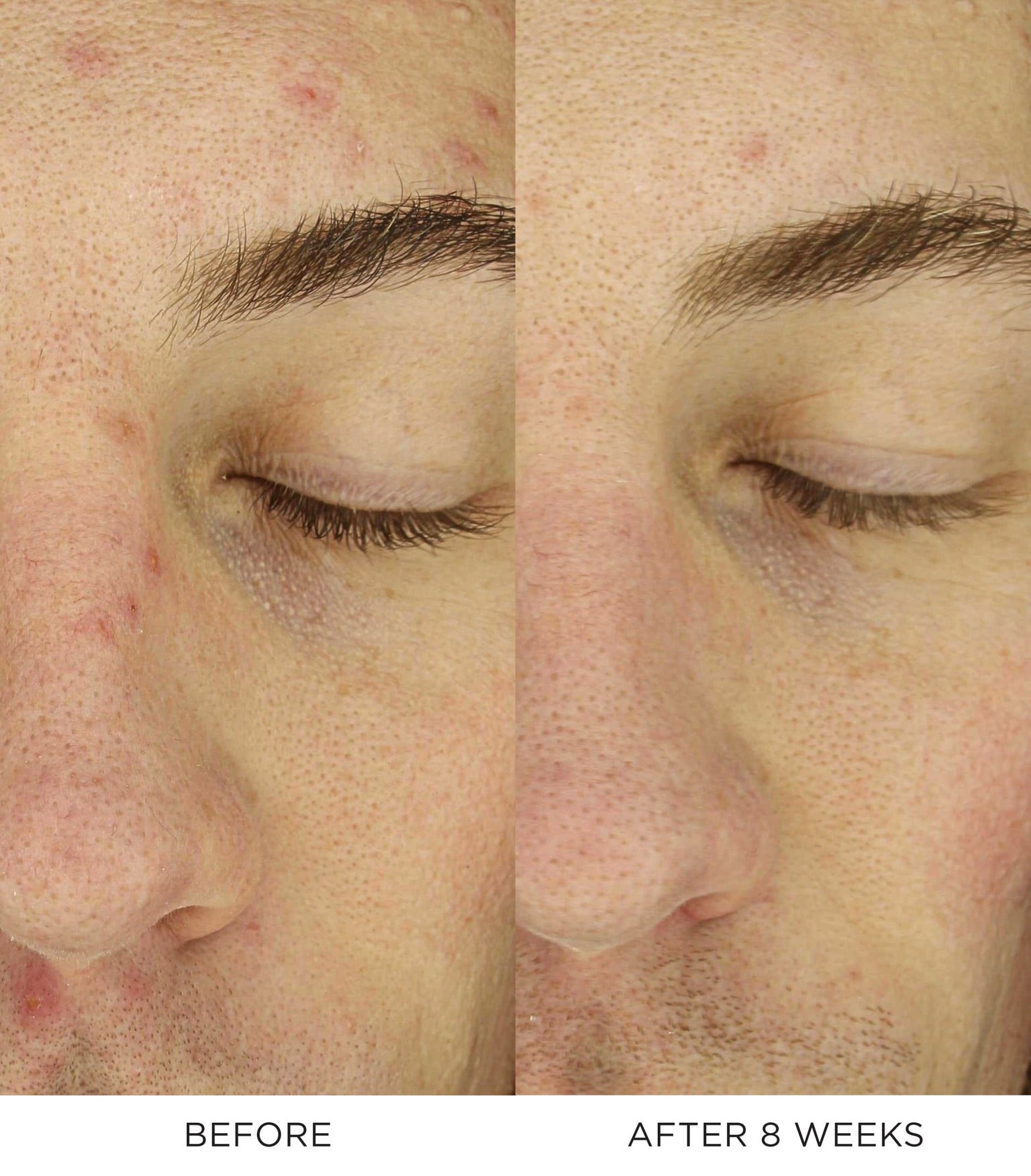 Overnight Chronobiology Peel 3
