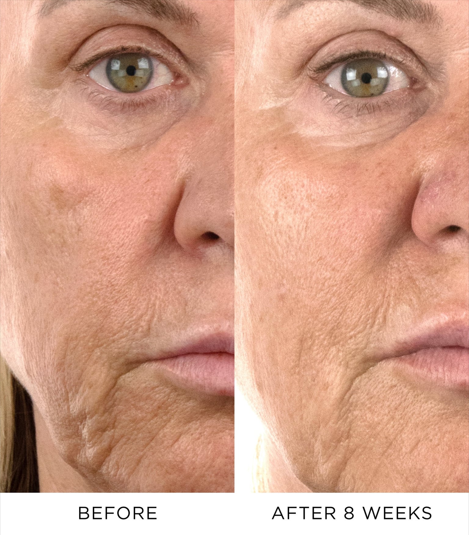 Intense Renewal Serum Refill 3