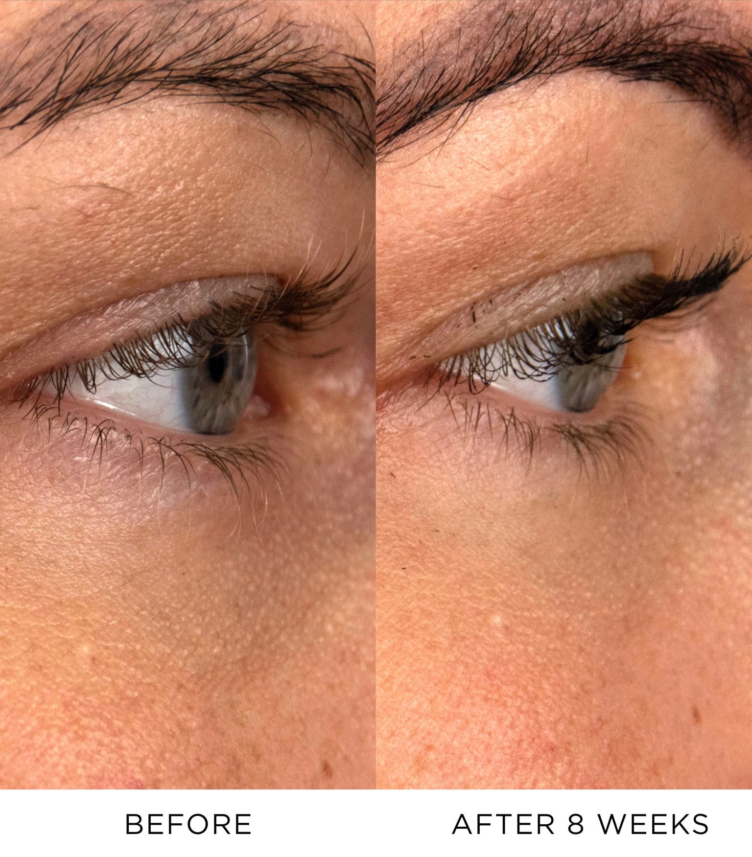 Vibrant Eye Infusion Refill 3