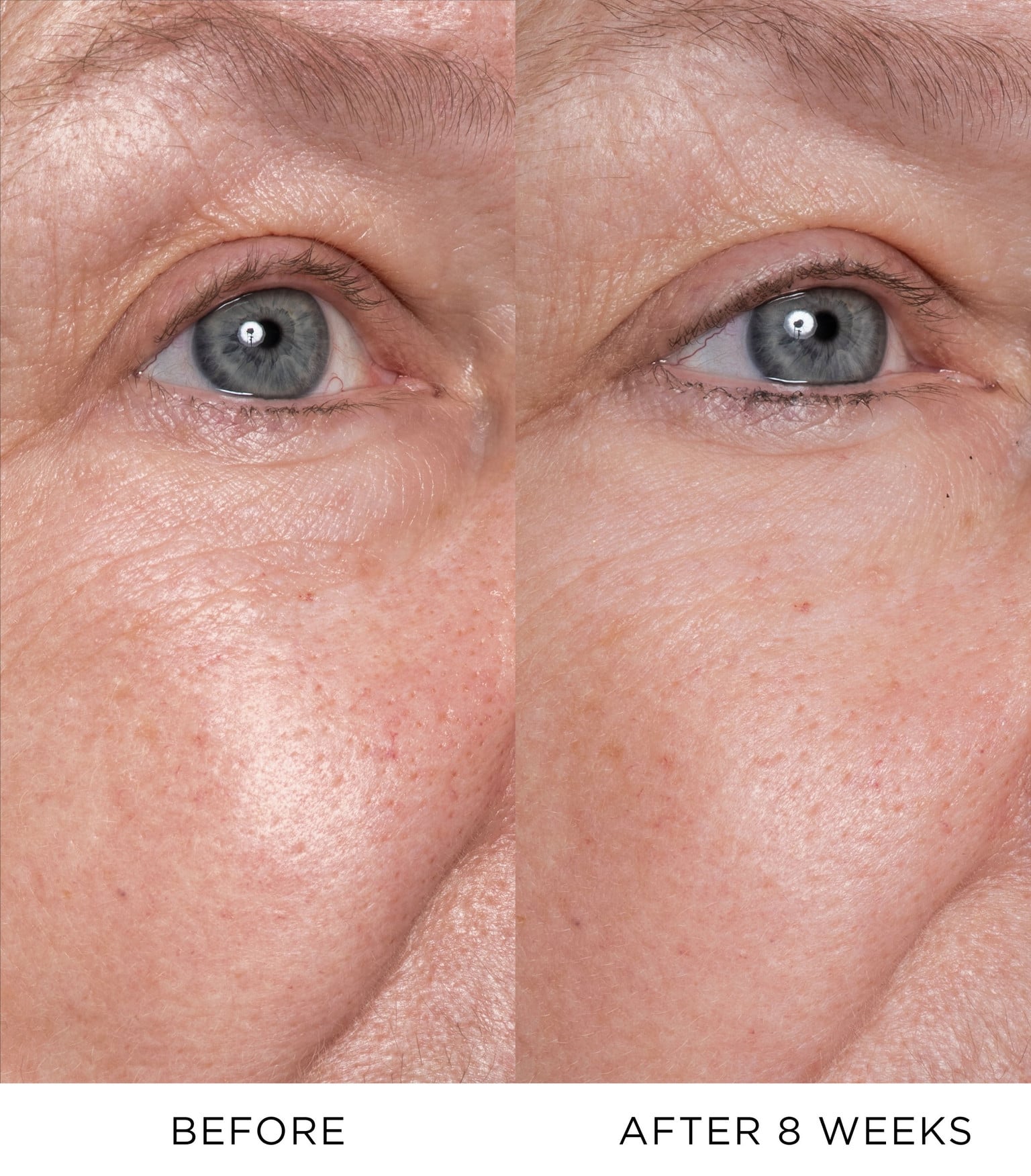 Eye Lift Concentrate 4