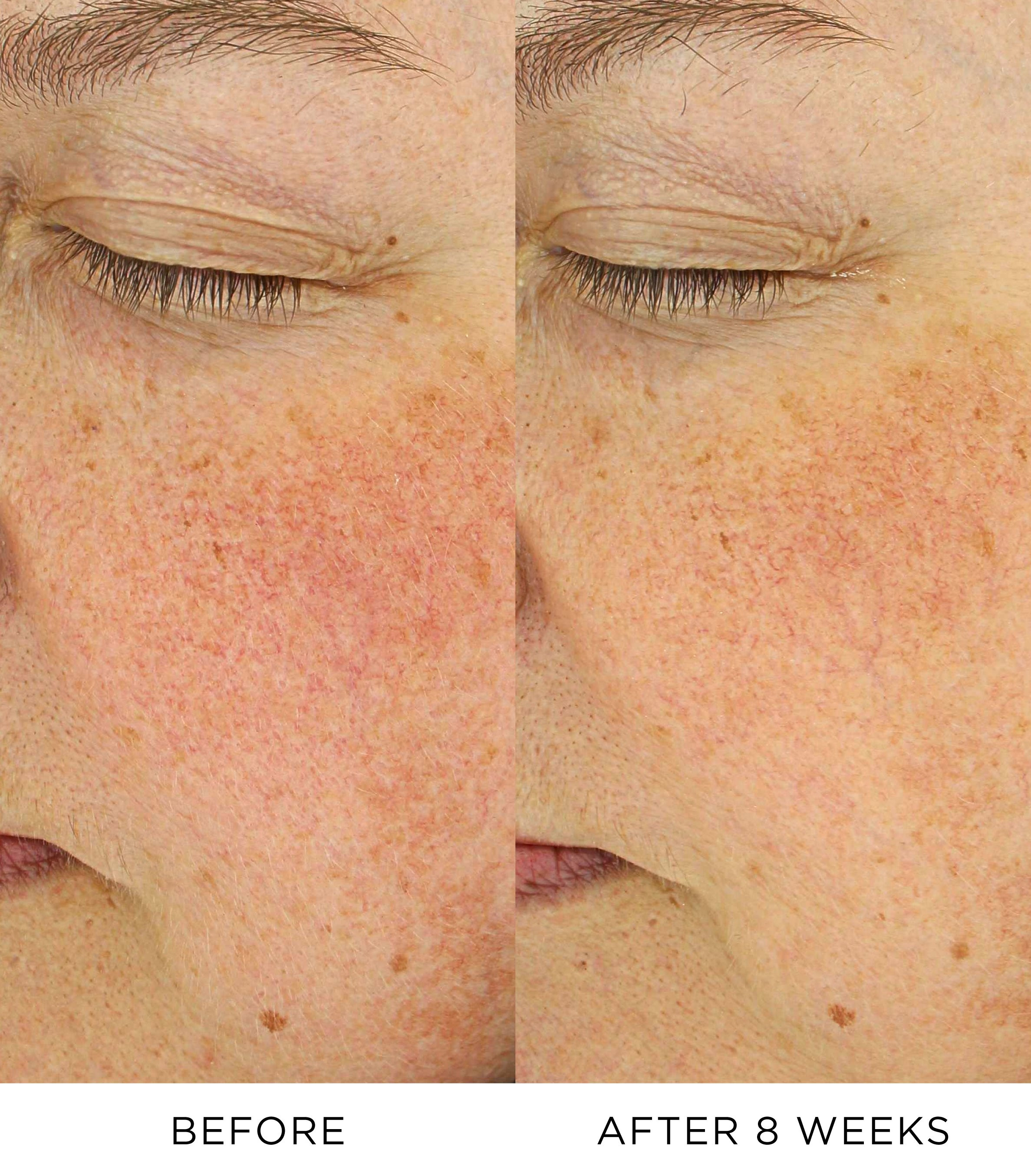 Vitamin C Booster 3