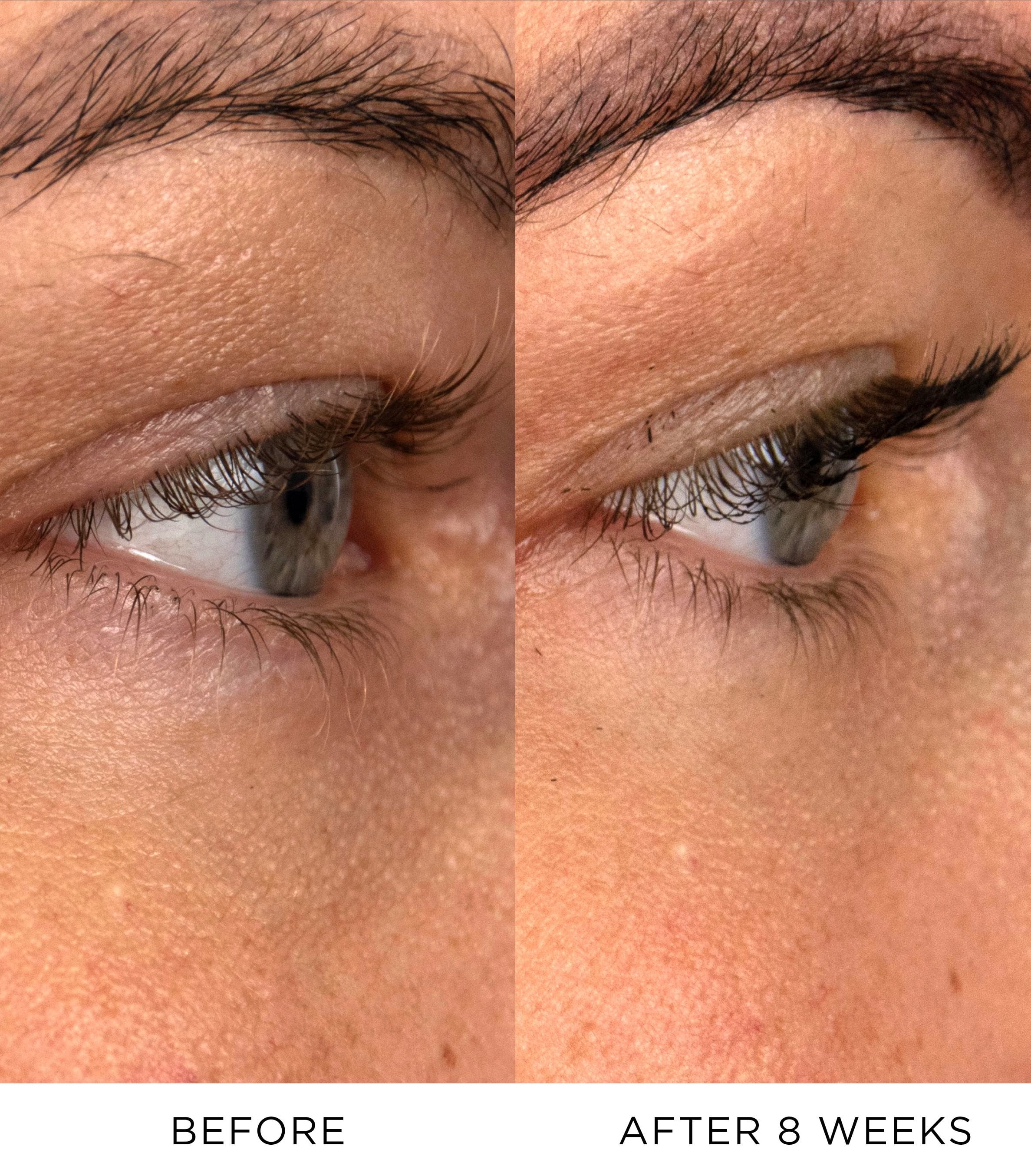 Vibrant Eye Infusion 3