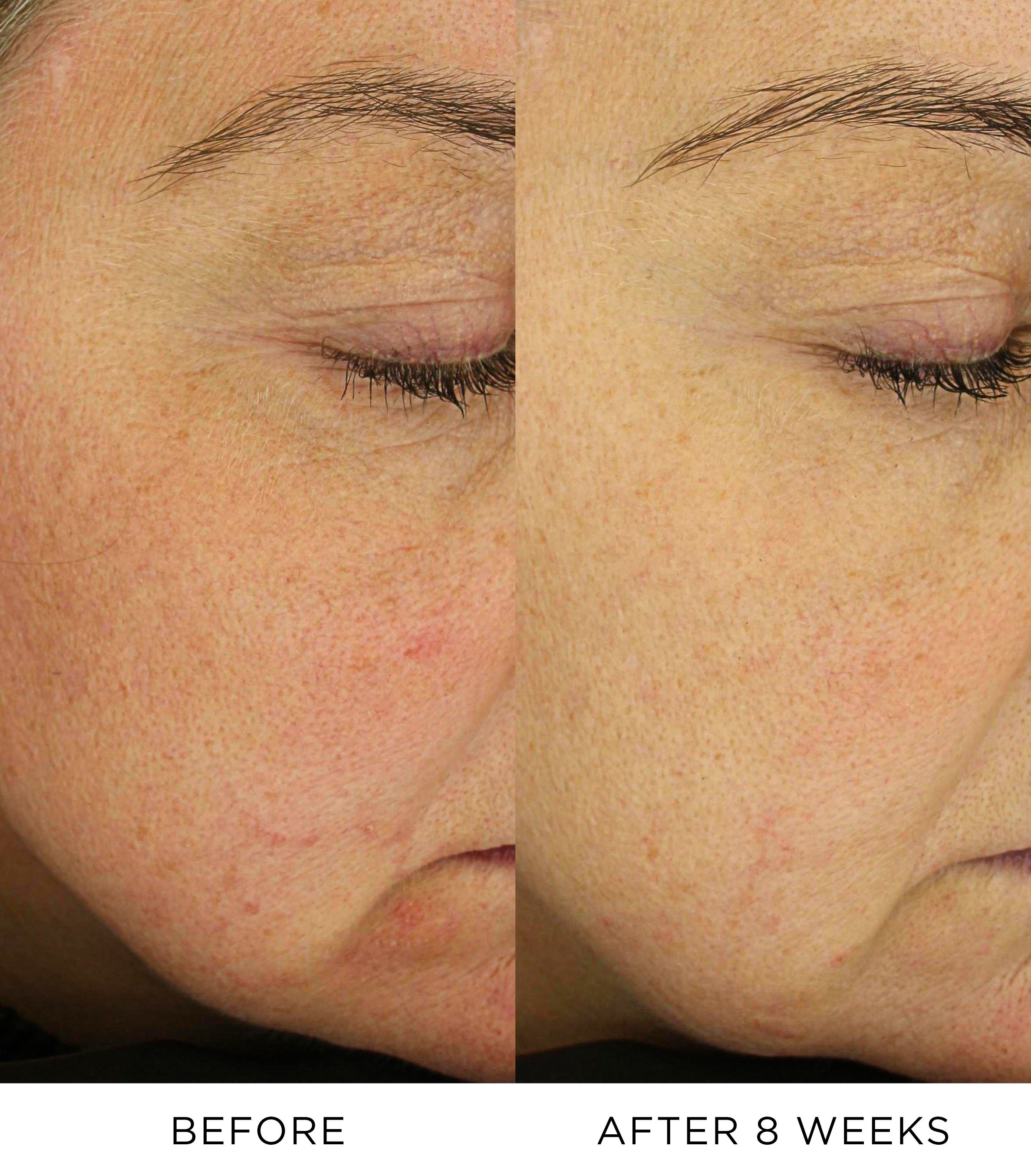 Nourishing Lift Oil 3