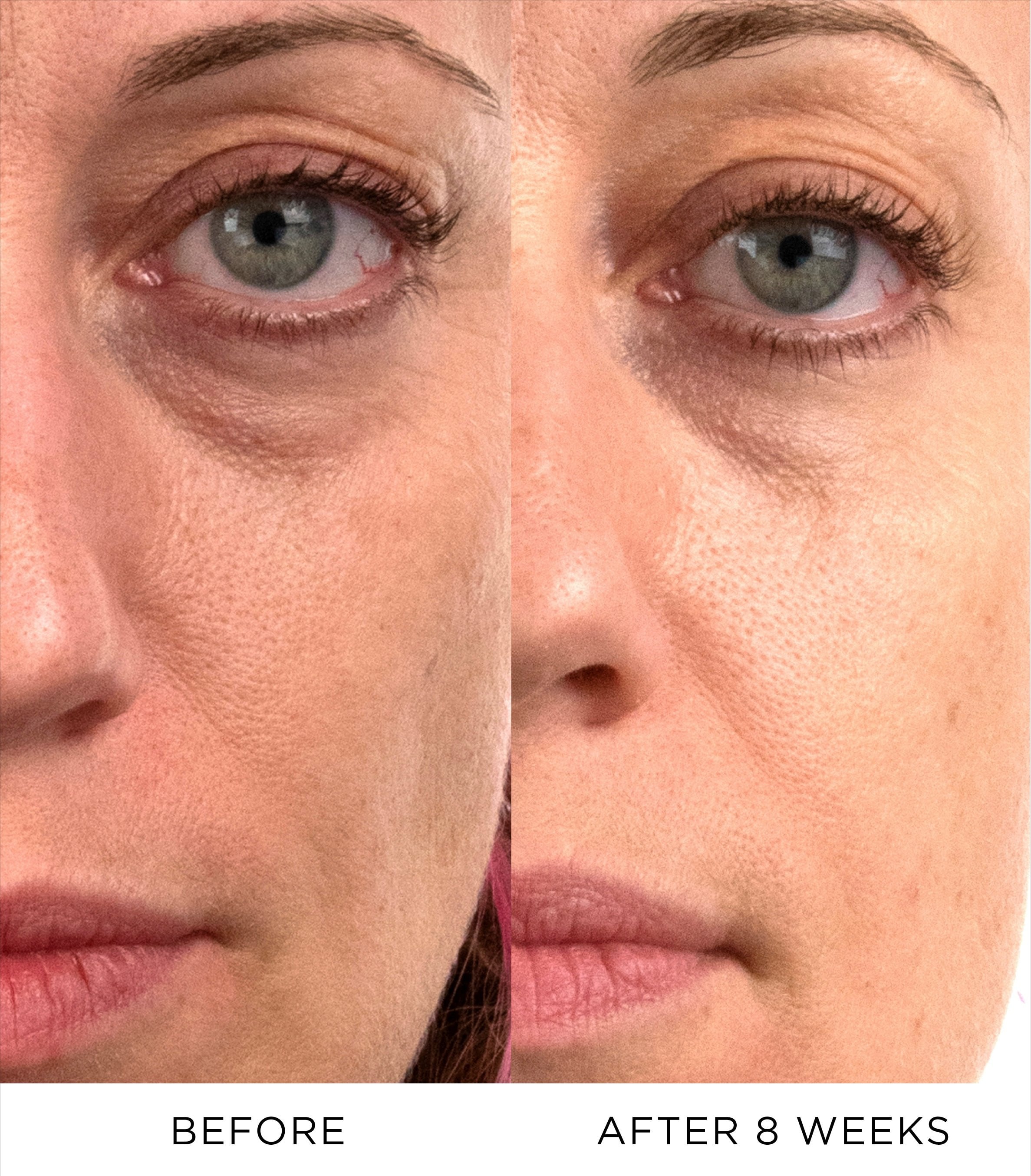 Prime Radiance Serum 7 Doses 3