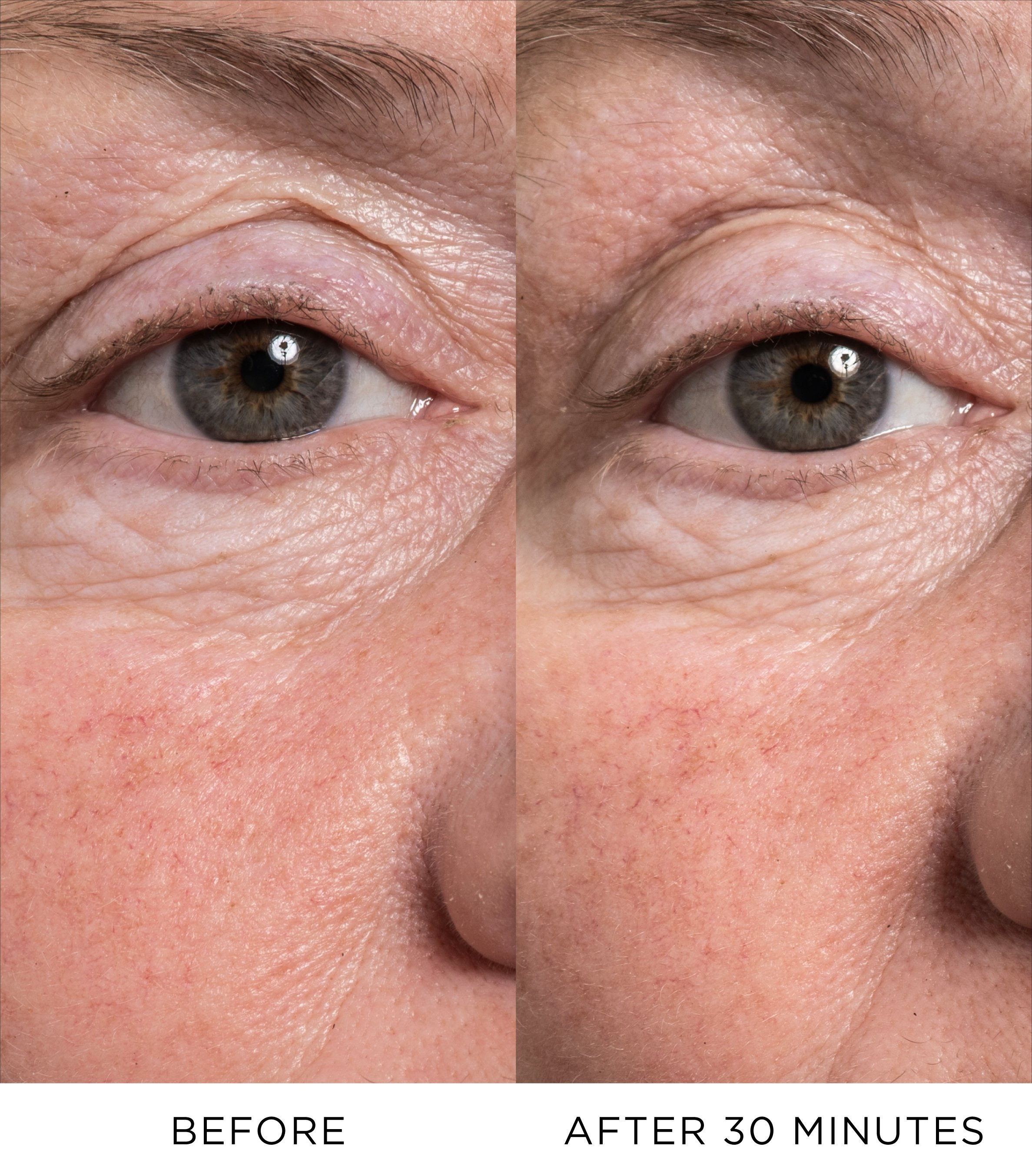 Eye Lift Concentrate | Noble Panacea