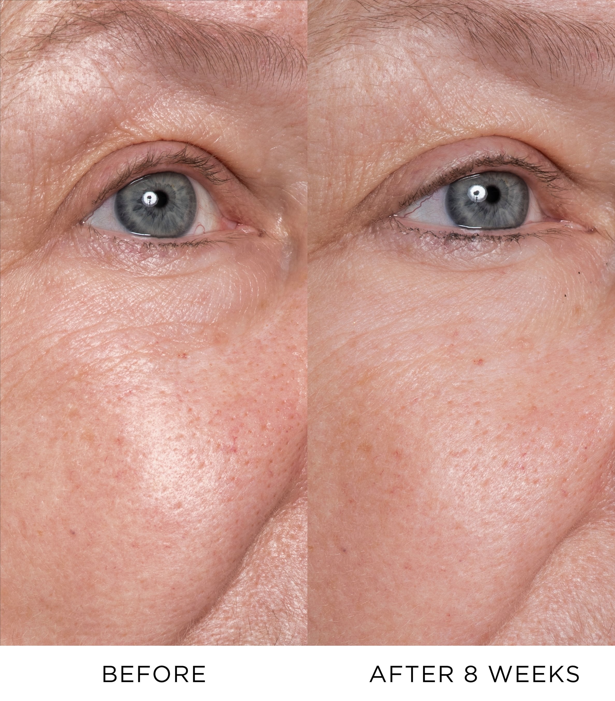 Eye Lift Concentrate Refill 4
