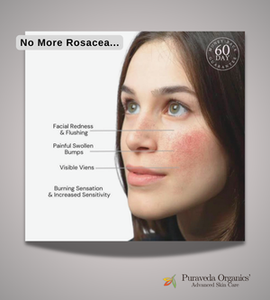 SBR SYSTEM: For Sensitive, Blemished, and Rosacea Skin