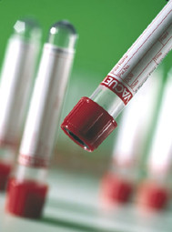 Greiner Vacuette Serum Tubes