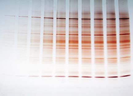 FASTsilver Silver Staining Kit by G-Biosciences — electrophoresis reagents from MedSupply Partners