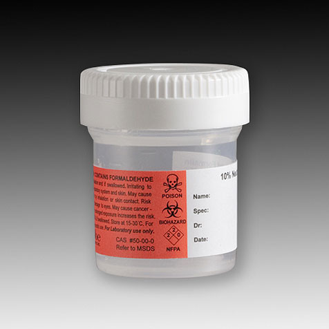 Formalin Filled Containers by Globe Scientific — glassware and plasticware from MedSupply Partners