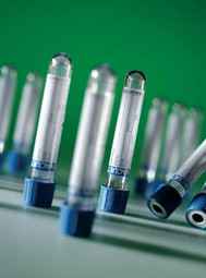 Greiner Vacuette Coagulation 3.2% Citrate Solution Evacuated Tubes by Greiner Bio-One — light blue top tubes from MedSupply Partners
