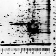 Autoradiography Ruler Set by Diversified Biotech — electrophoresis systems from MedSupply Partners