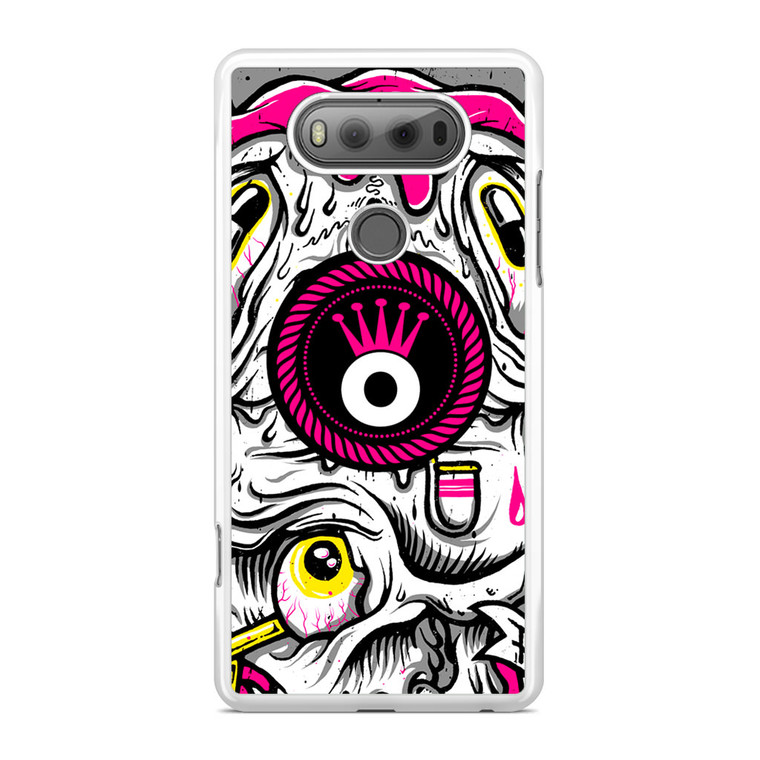 Anyforty 2 LG V20 Case