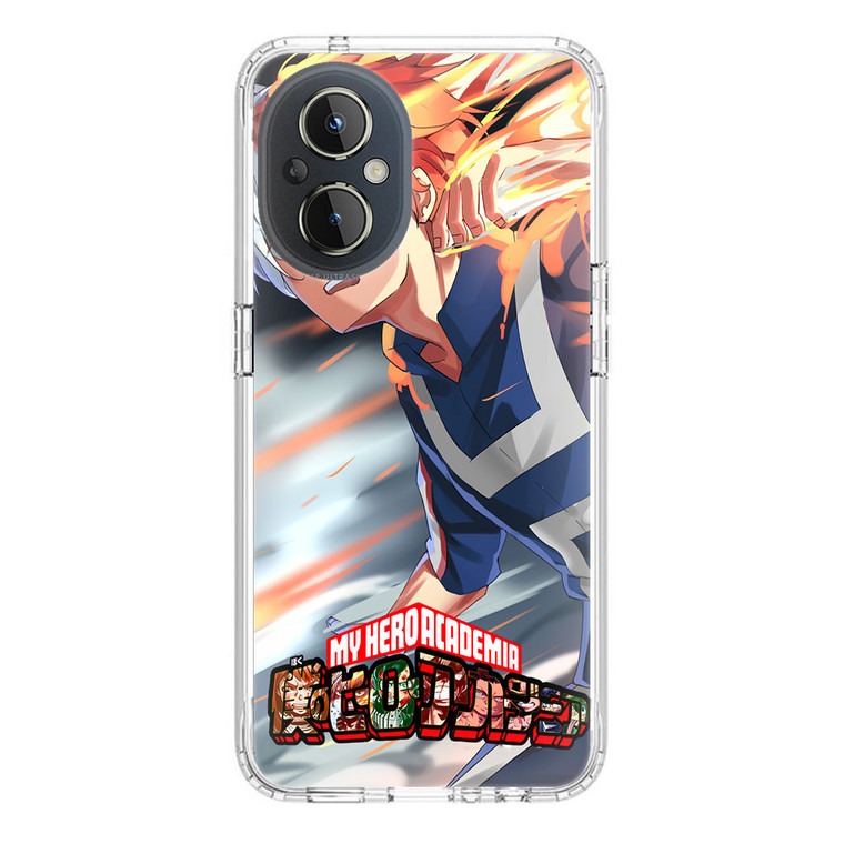 Shouto Todoroki My Hero Academia OnePlus Nord N20 5G Case