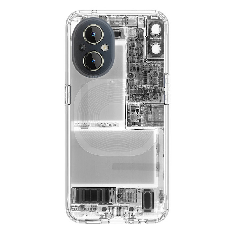 iPhone X X-ray OnePlus Nord N20 5G Case