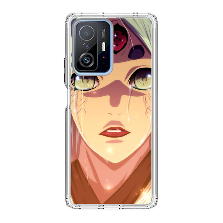 Naruto Kaguya Otsutsuki Xiaomi 11T Pro Case