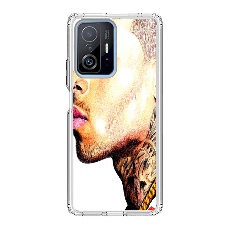 Music Chris Brown Xiaomi 11T Pro Case