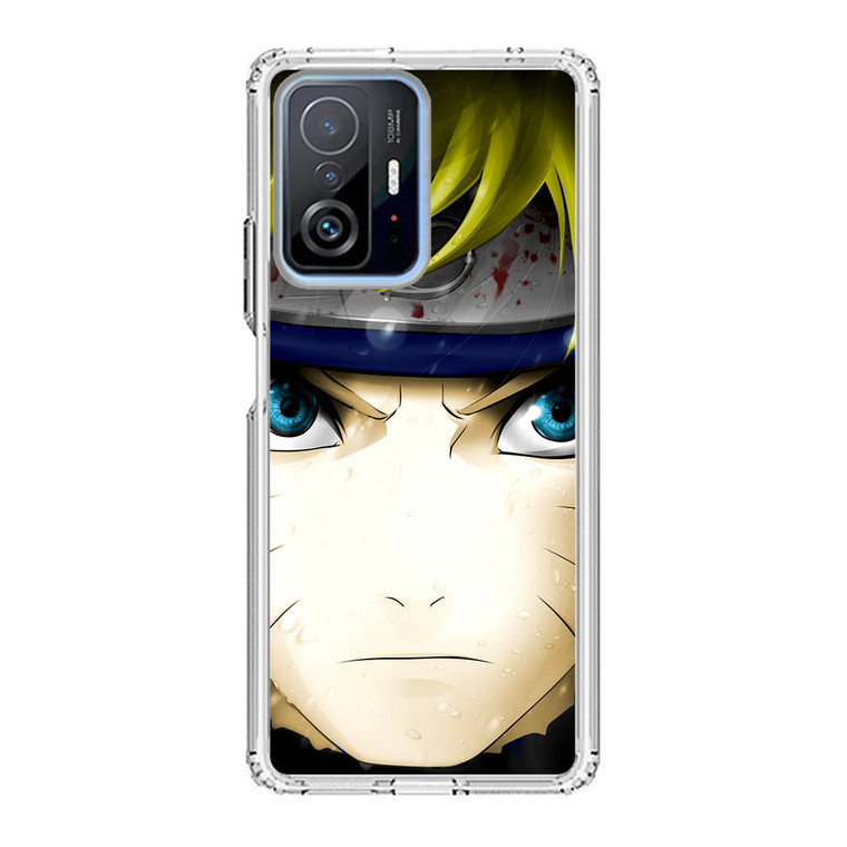 Naruto Uzumaki Naruto Xiaomi 11T Pro Case